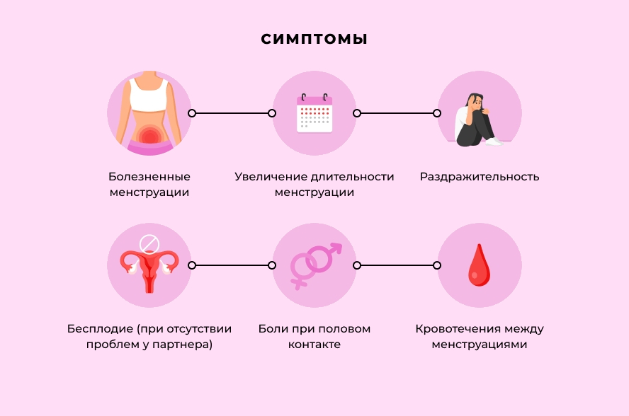 Симптомы аденомиоза матки