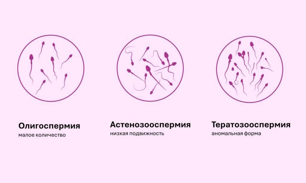 нарушения качества спермы