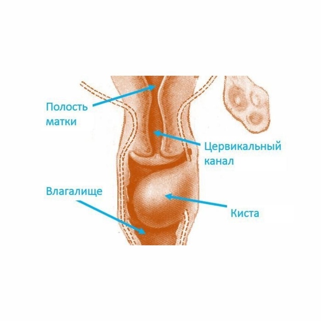 Лечение кисты влагалища в Израильском медицинском центре в Ташкенте
