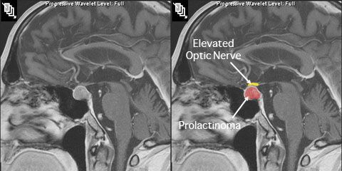 Диагностика гиперпролактинемии в Израильском медцентре в Ташкенте