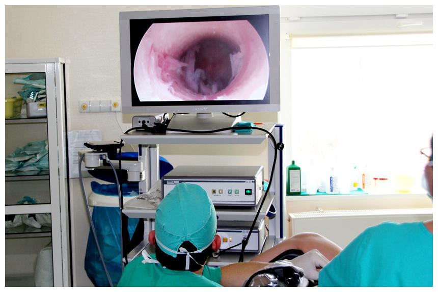 Гистероскопия в Израильском медицинском центре в Ташкенте. Современные методы лечения и профилактика осложнений.