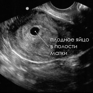 УЗИ определения ранних сроков беременности – до 7 недель в Израильском медицинском центре в Ташкенте. Современные методы лечения и профилактика осложнений.