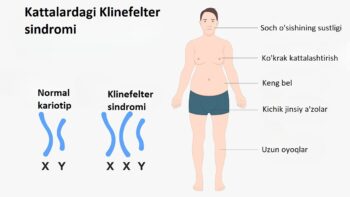 Kattalardagi Klinefelter sindromi