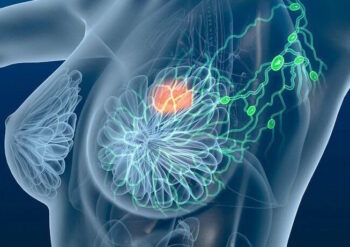 Четкое отличие доброкачественных образований (фиброаденомы, кисты) от злокачественных. Современная диагностика молочных желез в Израильском медицинском центре в Ташкенте