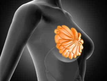 Уплотнение в молочной железе может быть связано с гормональными колебаниями, фиброзными изменениями или воспалением — точный диагноз поставит врач после обследования в Израильском медицинском центре